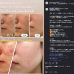 水戸のエステ「サクスィード」での肌ケアの経過を撮影した写真