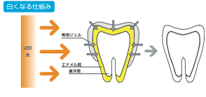 歯が白くなる仕組みを解説したイラスト図