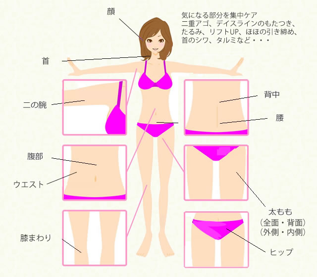 サーモシェイプ施術可能部位の解説図