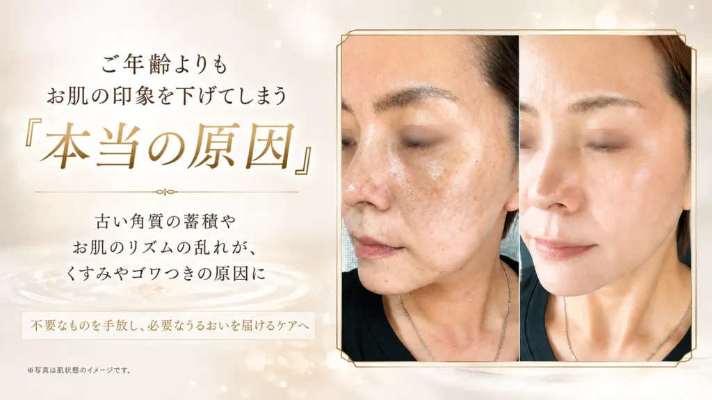 古い角質の蓄積や肌のリズムの乱れによる肌印象の変化を示した、サクスィードのフェイシャルケア見出し画像