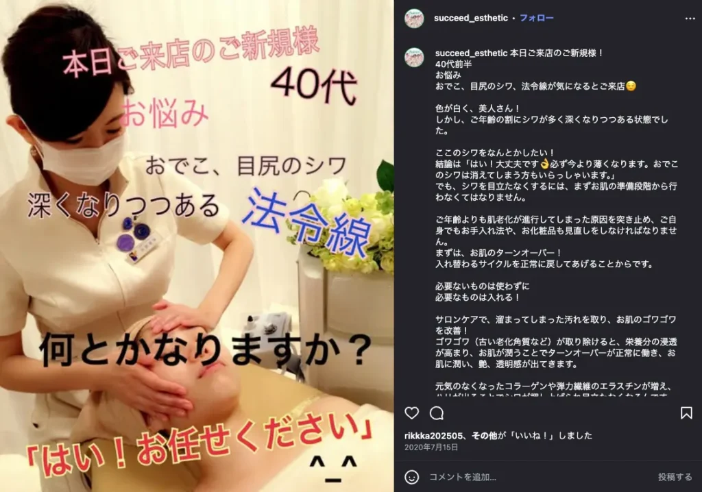 水戸のエステサロン「サクスィード」のフェイシャル施術風景。40代のお客様が抱えるおでこや目元・口元の年齢サインのお悩みに寄り添うオーダーメイドケアの様子